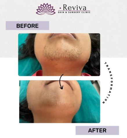 Before and after result 7